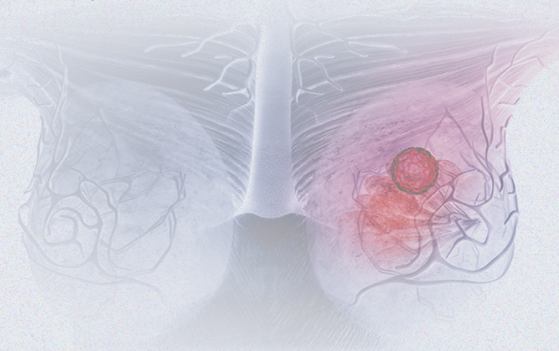 國(guó)際婦女節(jié) | 關(guān)注乳腺癌 微創(chuàng)介入讓美麗繼續(xù)，「乳」愿以償正成為現(xiàn)實(shí)
