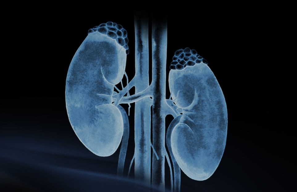 世界腎臟日 | 相得「腎」歡，融有術(shù)、精準(zhǔn)適形